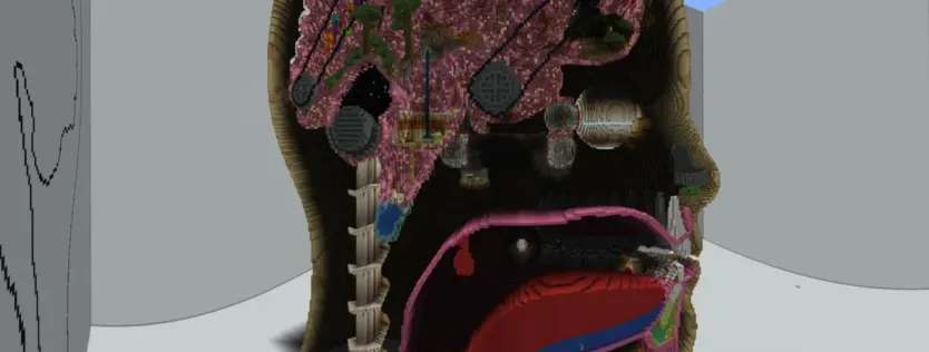 Brain-Box
